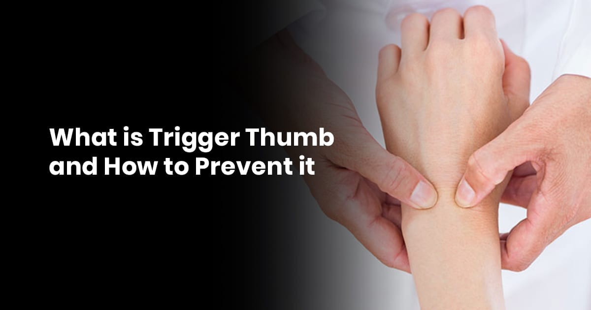 What is Trigger Thumb and How to Prevent it